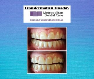 Homepage Dentist Denver Lone Tree