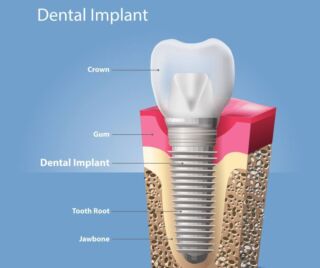 Homepage Dentist Denver Lone Tree
